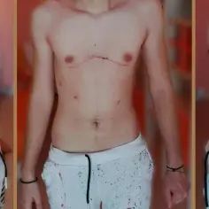 Pectus co znaczy po polsku? Łacińskie słowo w anatomii
