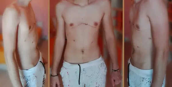 Pectus co znaczy po polsku? Łacińskie słowo w anatomii